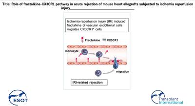 Role of Fractalkine-CX3CR1 Axis in Acute Rejection of Mouse Heart Allografts Subjected to Ischemia Reperfusion Injury